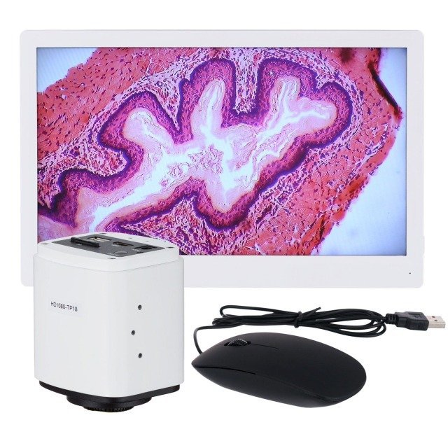 imageye___-_imgi_41_hd1080-tp18_with-mouse.jpeg AmScope HD1080-HDM 1080p 60fps 2MP HDMI High-sensitivity Color CMOS C-mount Microscope Camera with Monitor for Stand-alone and PC Imaging - Image 1